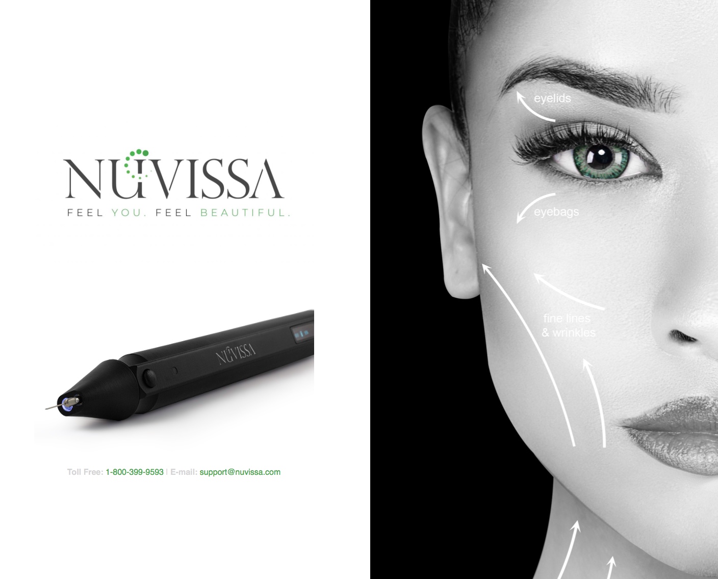 NUVISSA - Imagen 2